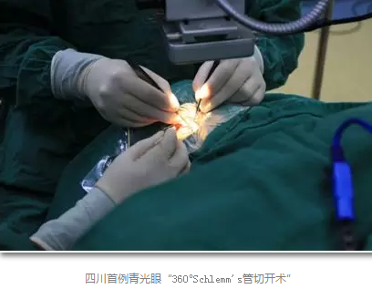 成都6686体育(中国)官方网站 - 登录入口已经开展的青光眼手术有：引流阀 (钉)植入手术(2015年以来已200多 )，360°Schlemm's管切开术，激光CO2 辅助巩膜深层切除术，小梁切除术青(光眼)白(内障)联合手术。还有虹膜周切术、前房成形术、 虹膜复位术，睫状体冷冻术，小梁切开术和前房穿刺术等6.png