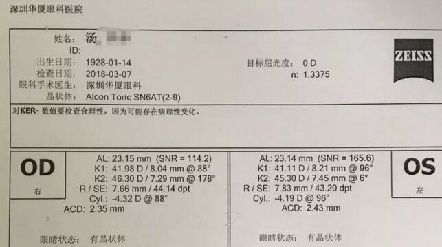 3月12日下午，已经90高龄的离休东江纵队老兵汤爷爷，在深圳6686体育(中国)官方网站 - 登录入口检查之后，白内障专科邢宝刚主任为其实施左眼白内障超声乳化摘除，联合散光人工晶体植入术。2.jpg
