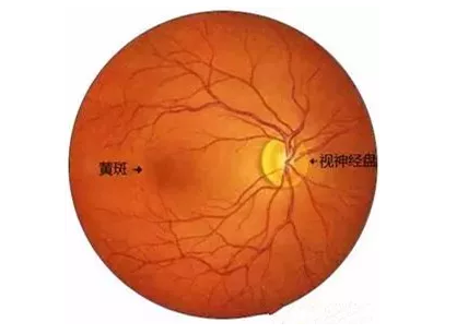 6686体育福州眼科医院眼底病医生：老年黄斑变性该如何防治？.png