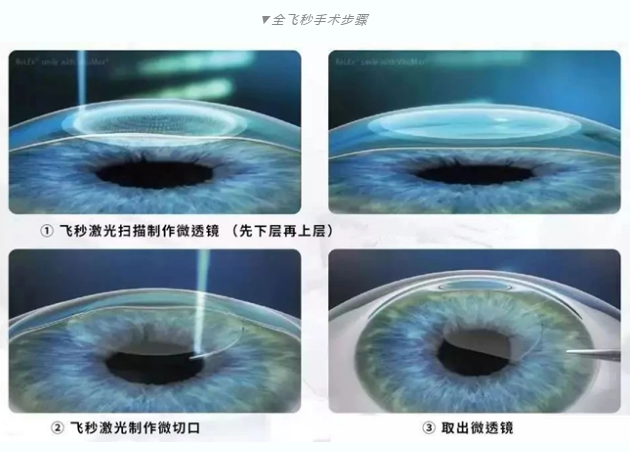 7月26日来深圳6686体育(中国)官方网站 - 登录入口参与暑期摘镜季活动就可以有机会参与抽奖免单手术！2.png