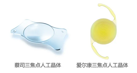 我看到了9个月亮，中国医生一招解决！“洋女婿”患白内障几近失明，在厦门眼科中心手术4.png